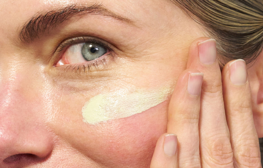 How To Reduce Skin Redness | Skincare Routine for Redness-Prone Skin