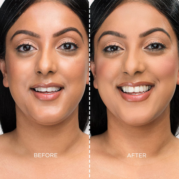 Before and after model