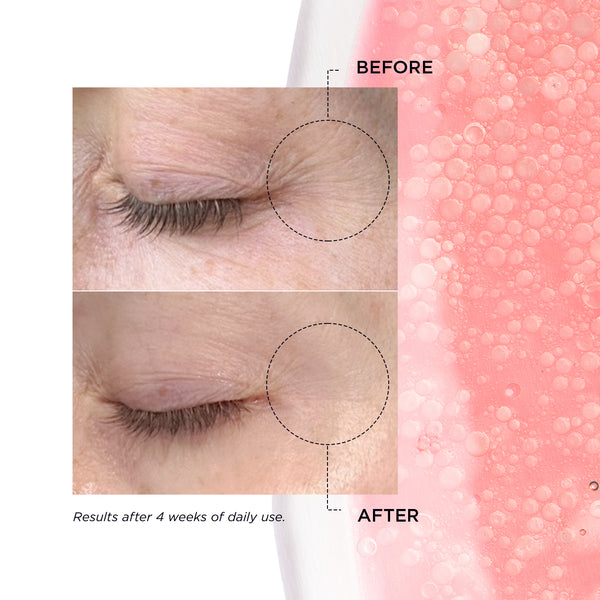 Before and after comparison showing reduced wrinkles around the eye area after 4 weeks of daily use of Youth Potion Enriched Retinal Complex