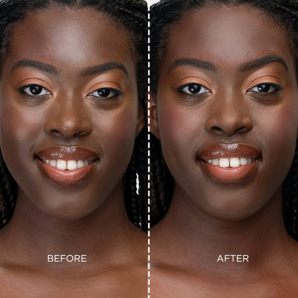 Before and after model