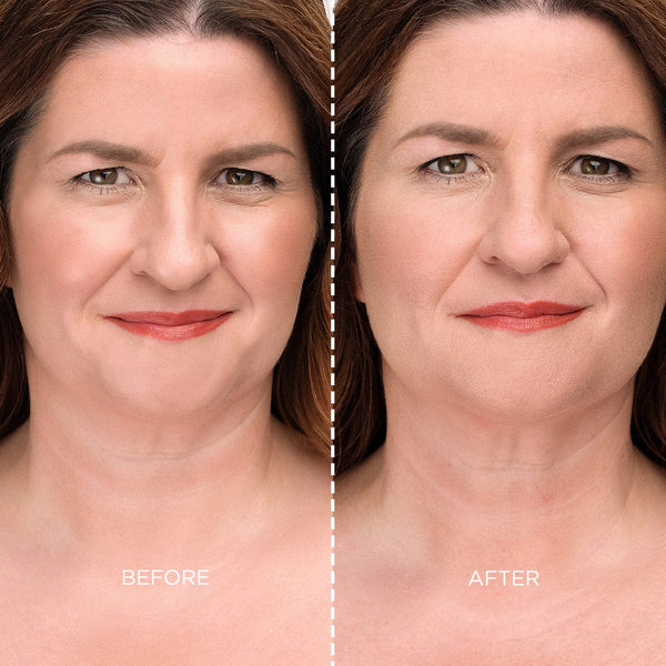 Before and after model